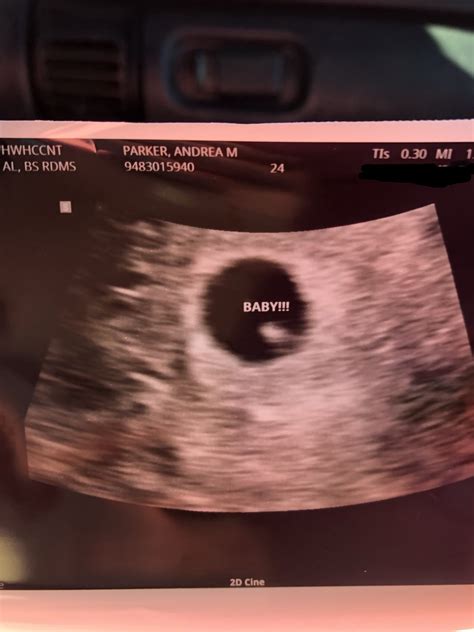 2 months pregnant pictures.